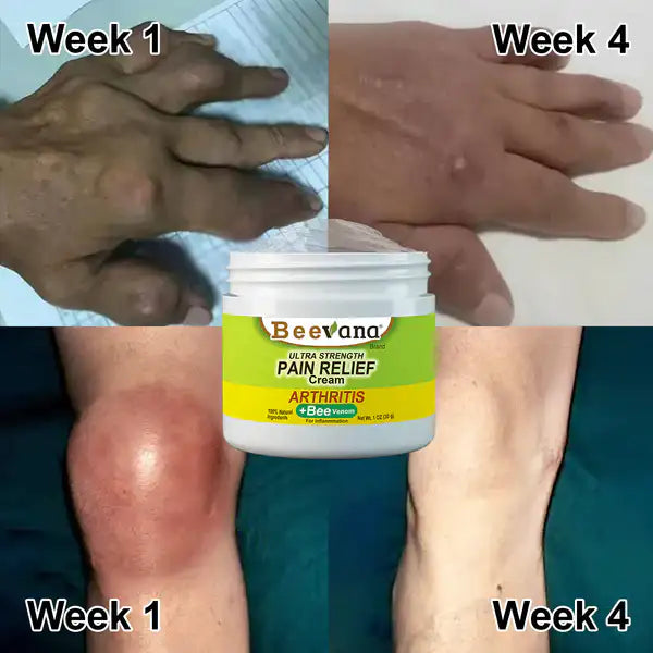 2x1 Beevana™ - Crema para el dolor de articulaciones