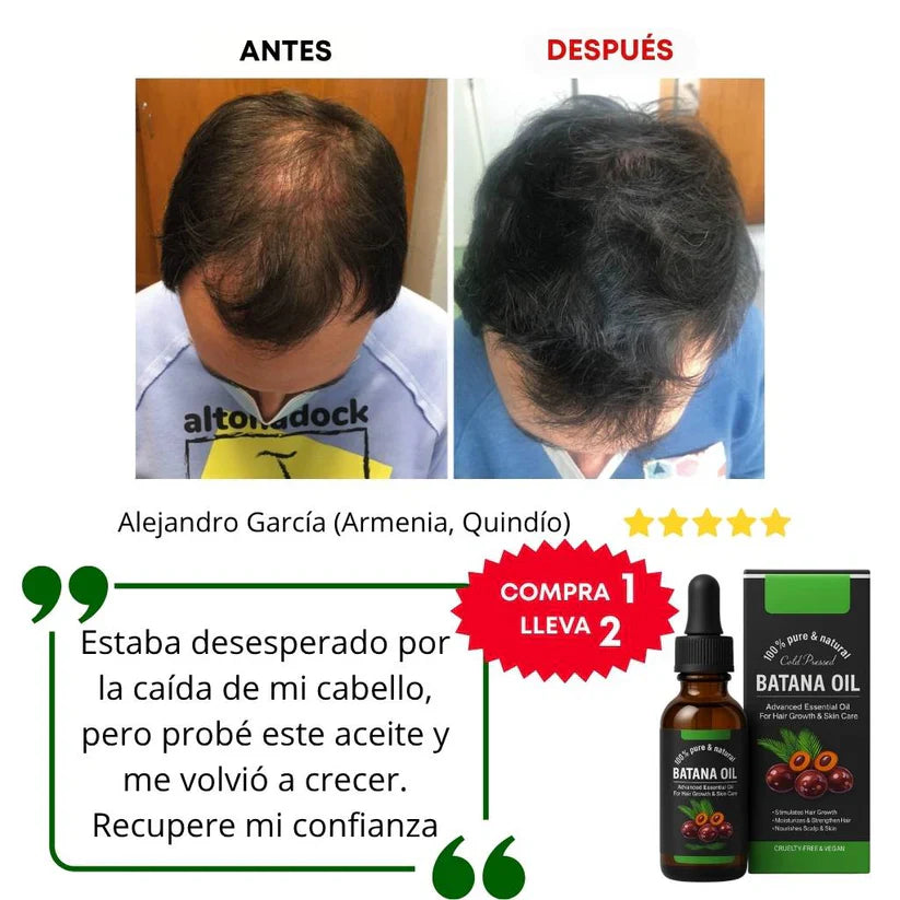 2X1 ACEITE DE BATANA OIL | Tratamiento Restauracion Capilar , 100% puro romero y batana natural