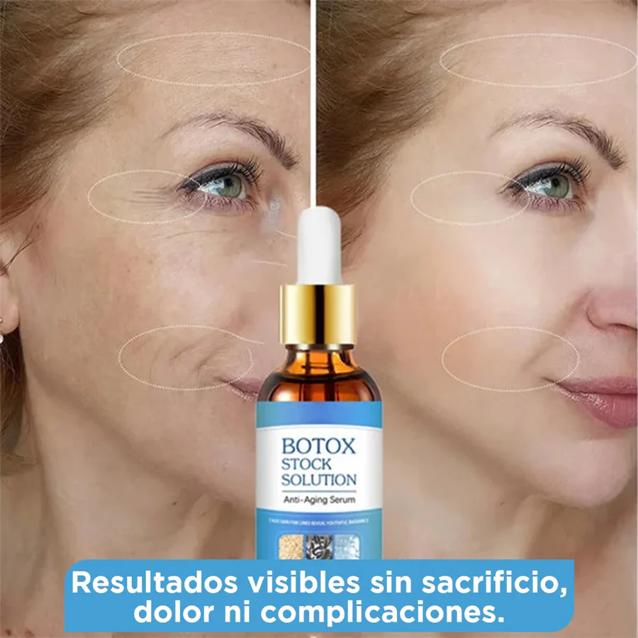 ¿Fórmula Mágica para Arrugas? Conoce DermaTox –Rejuvenecimiento Sin Agujas!