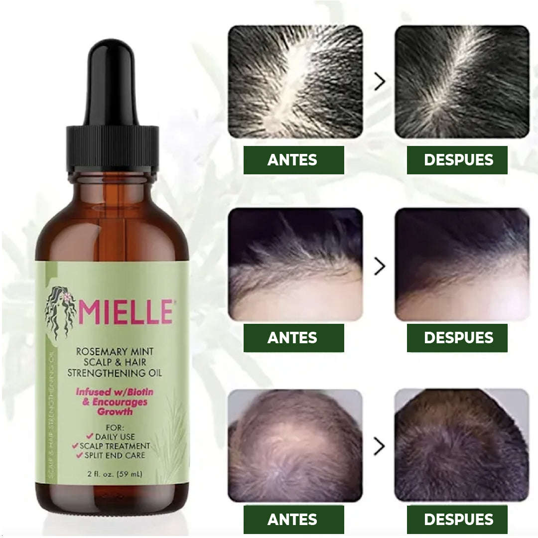 Mielle Rosemary™ - Aceite de Romero