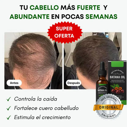 2X1 ACEITE DE BATANA OIL | Tratamiento Restauracion Capilar , 100% puro romero y batana natural