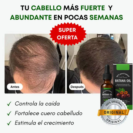 2X1 ACEITE DE BATANA OIL | Tratamiento Restauracion Capilar , 100% puro romero y batana natural