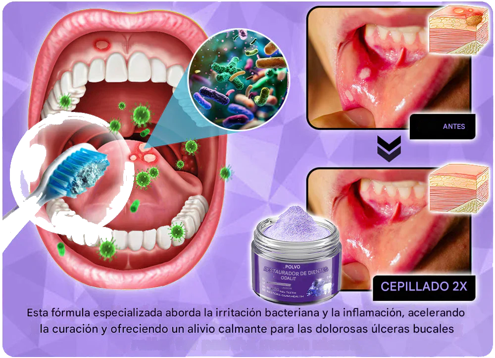 2X1 ODALIT™ - POLVO RESTAURADOR DENTAL