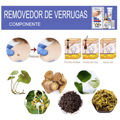 KIT 2X1 WART BLACKHEADS - Removedor automático de verrugas